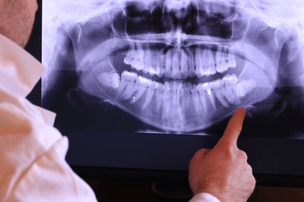 Best Emergency Gum Pain Relief  in Lewisville, TX