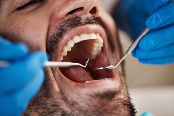 Best Cracked Tooth Emergency Dentist  in Lewisville, TX
